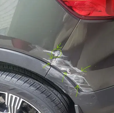 Rogers dent